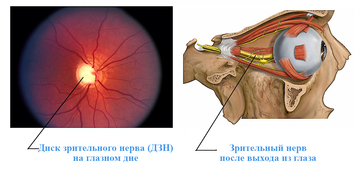 Новое в лечении частичной атрофии зрительного нерва (ЧАЗН) - аппараты для применения в домашних условиях