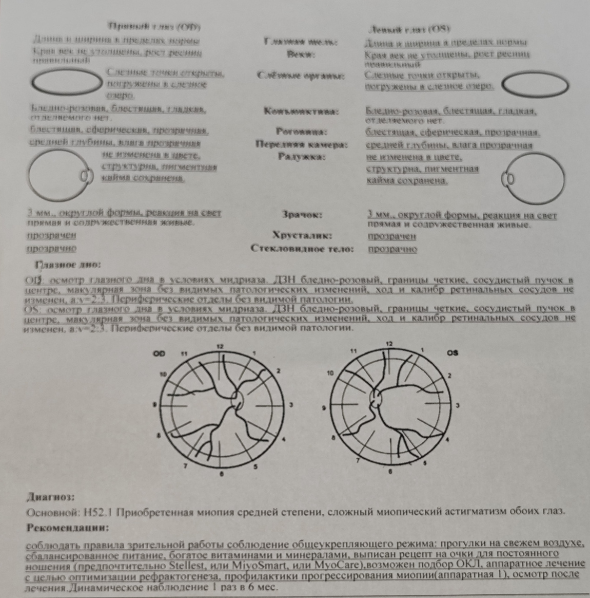 H52.1 Приобретённая миопия средней степени, сложный миопический астигматизм