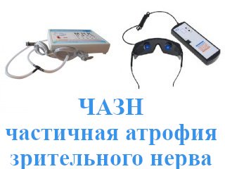 Лечение ЧАЗН - частичной атрофии зрительного нерва глаза в домашних условиях - очки Панкова и Сидоренко